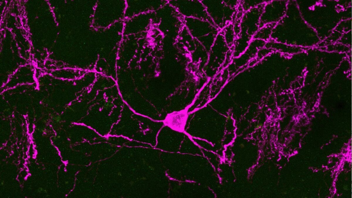 New stem cell study raises hopes for Parkinson’s treatment