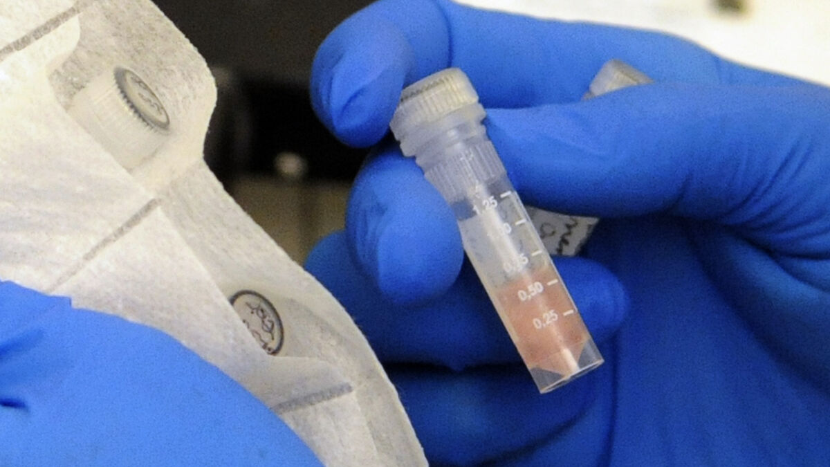 More British cases of meningitis