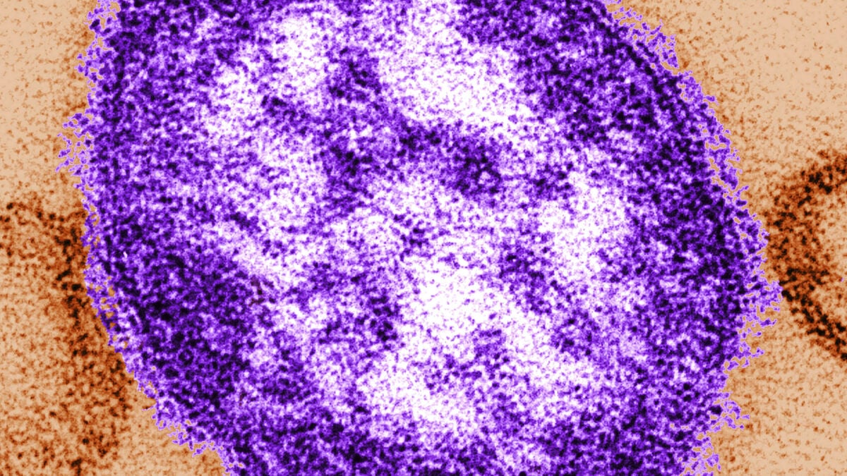 Eleven measles cases confirmed after Urkult Festival, new case in Stockholm