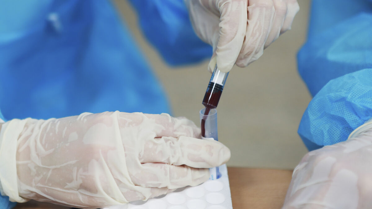 Russian plague researcher dies of