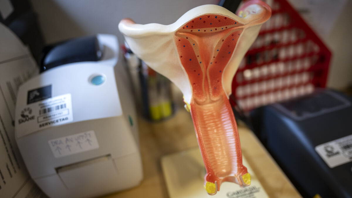 Symptoms worsened for Swedish endometriosis patients after nerve procedure in Romania