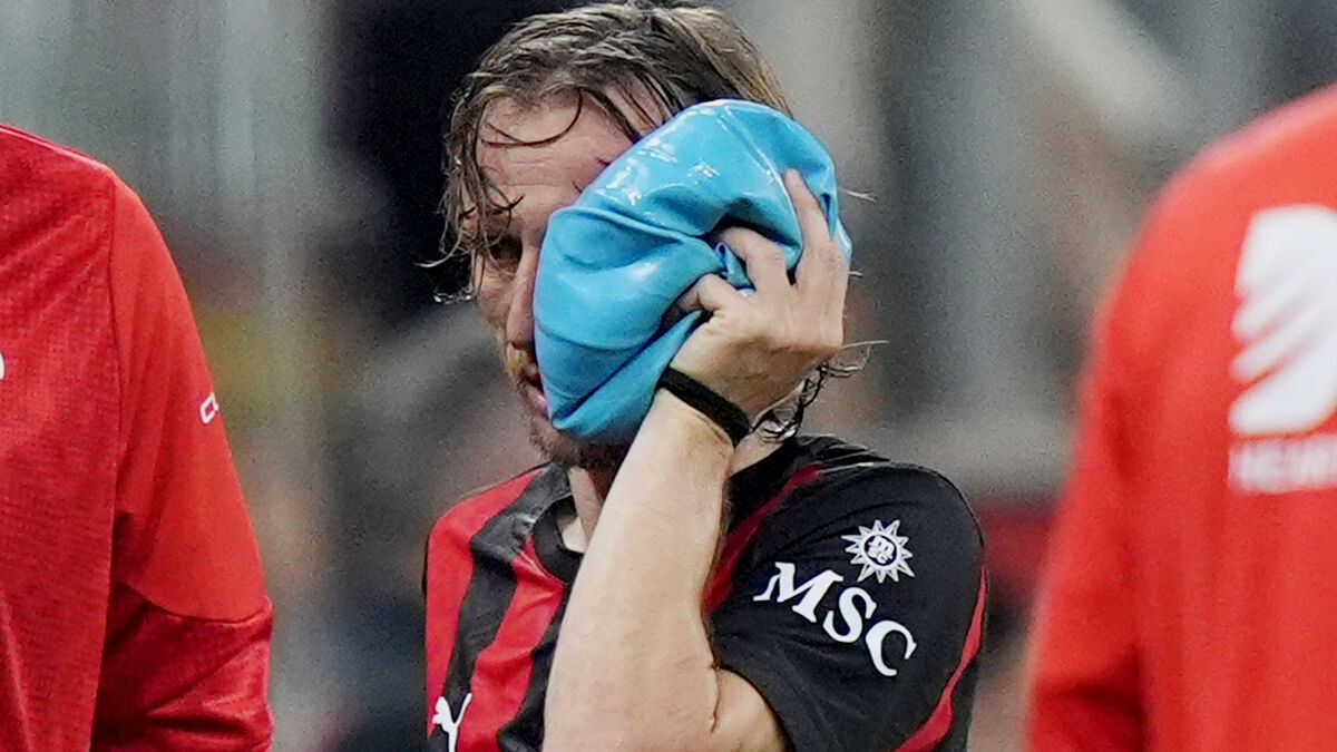 Fractured cheekbone - Luka Modric to undergo surgery
