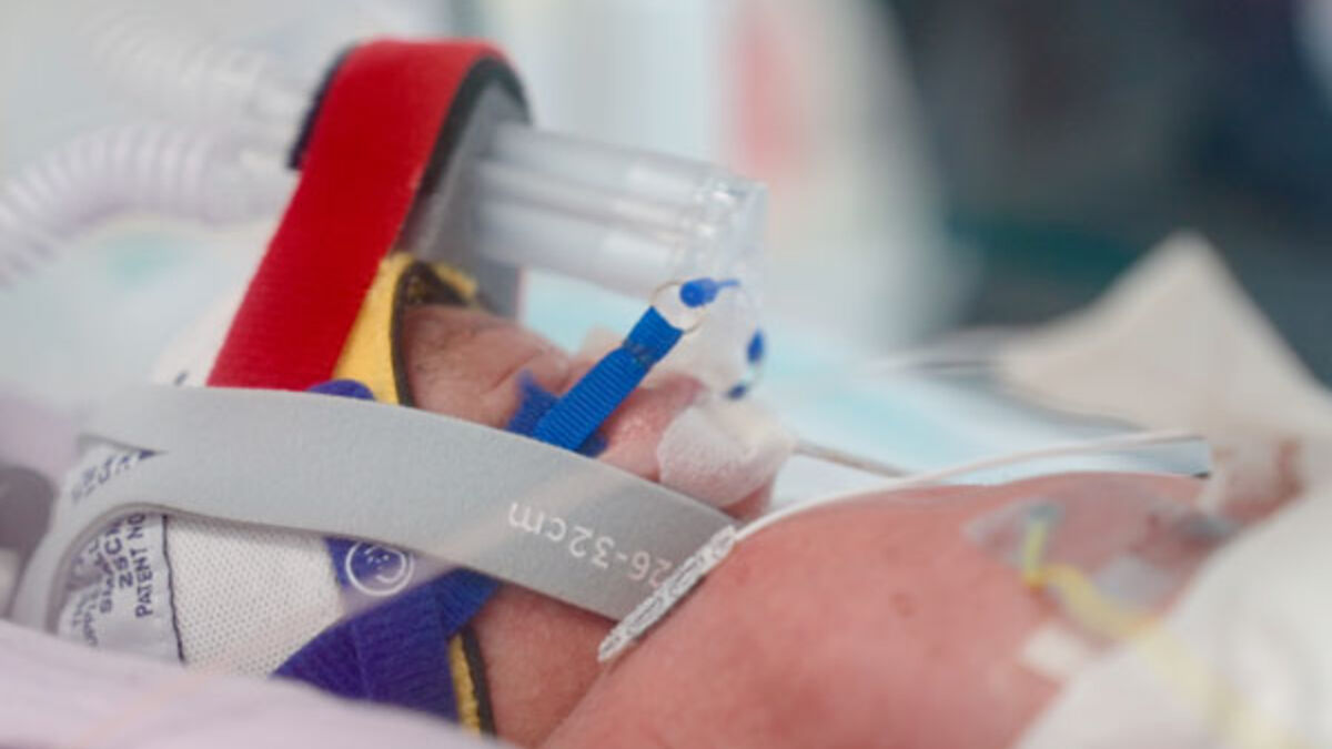 Identical quadruplets born in Australia