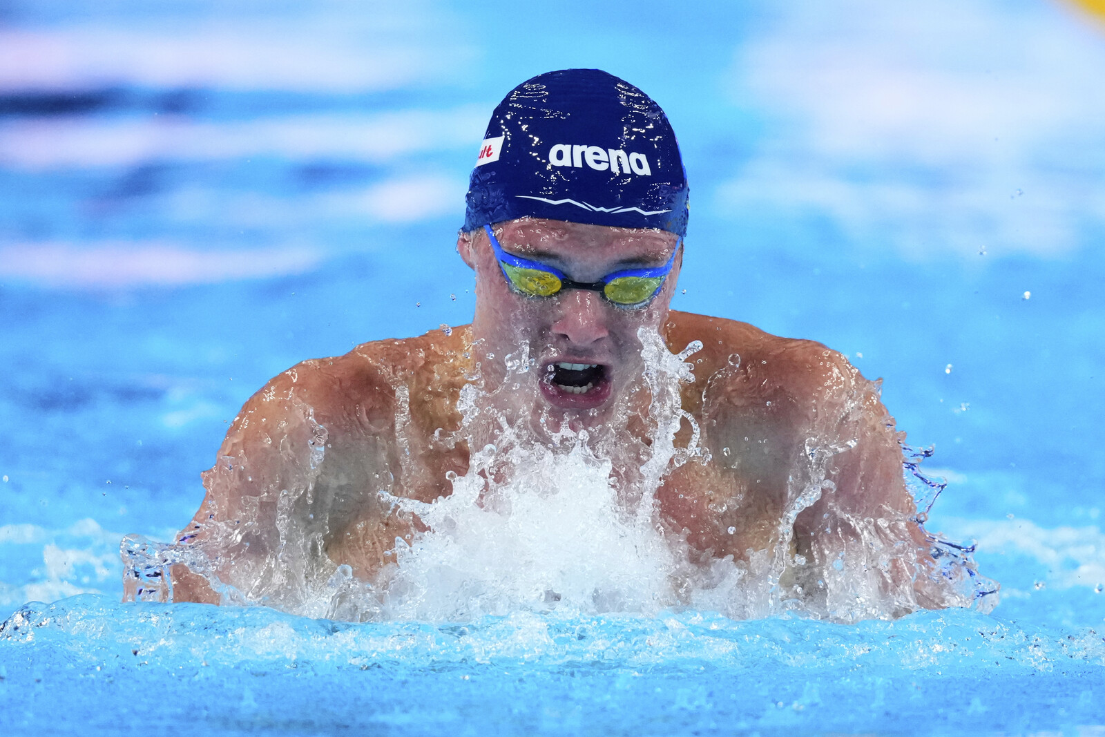 Stomach Bug Spreads at World