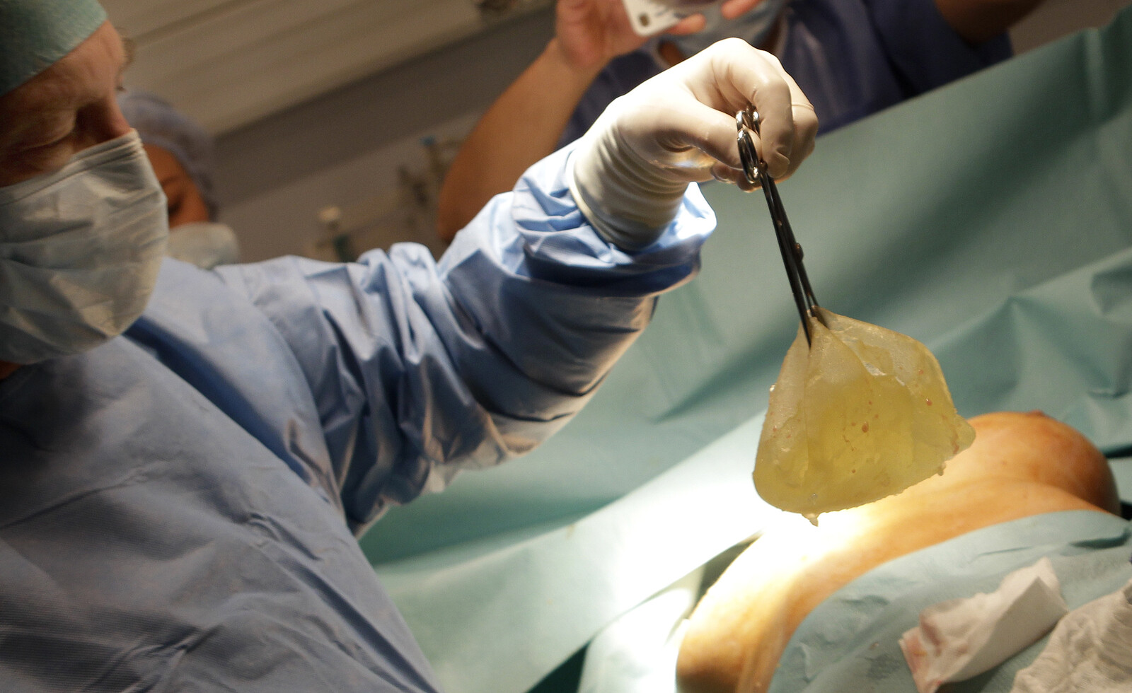 The new owner of Bilprovningen embroiled in breast implant scandal