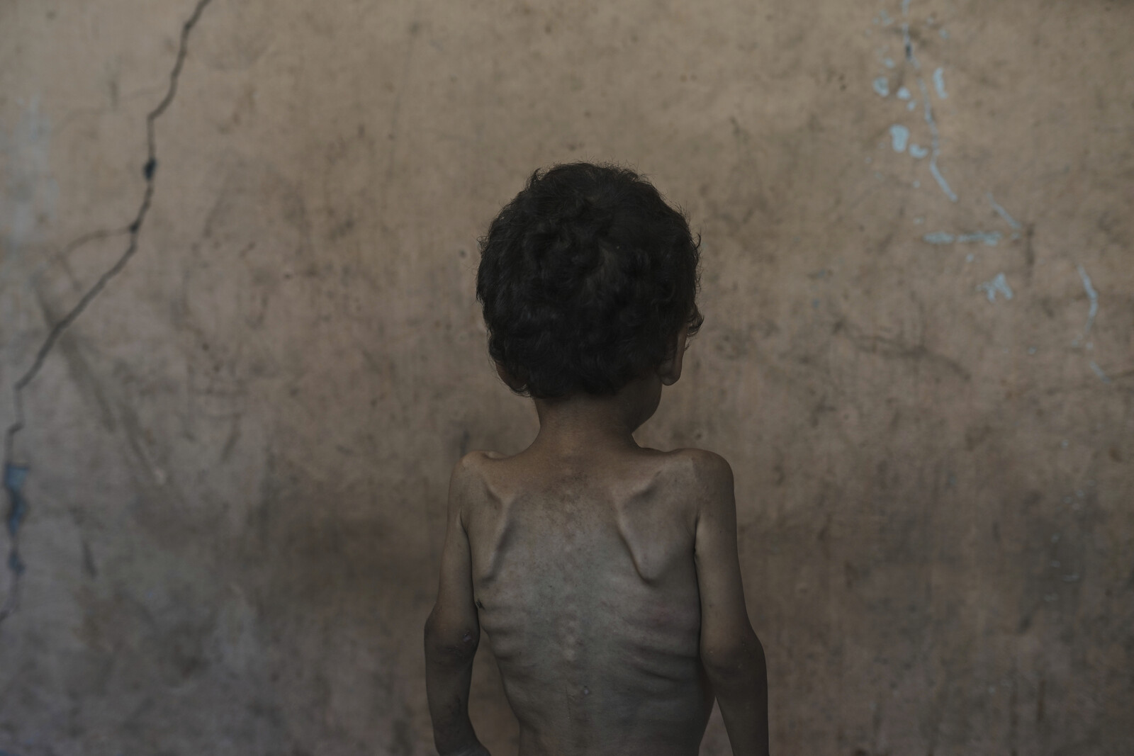 Gaza Crisis: UN Urges More