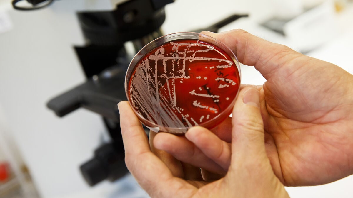 Treatment-resistant gonorrhea is spreading in Sweden, health agency says