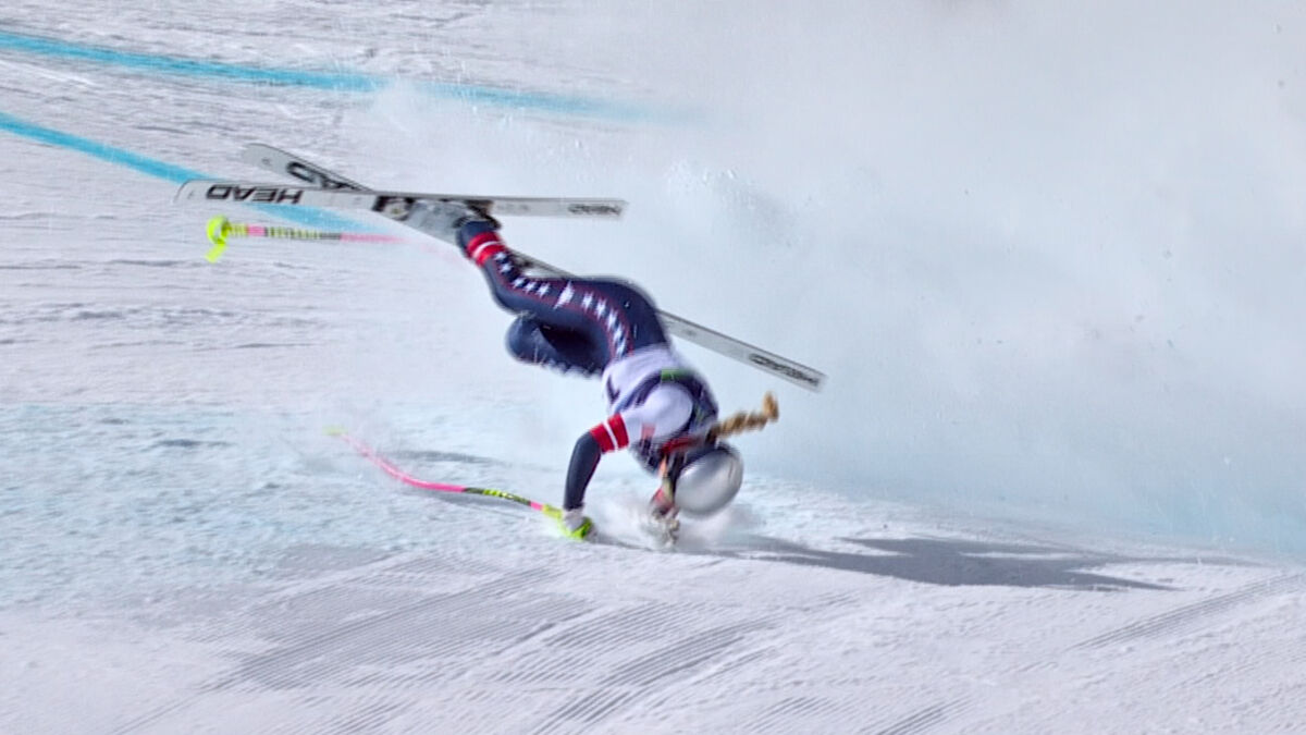 Lindsey Vonn after surgery can