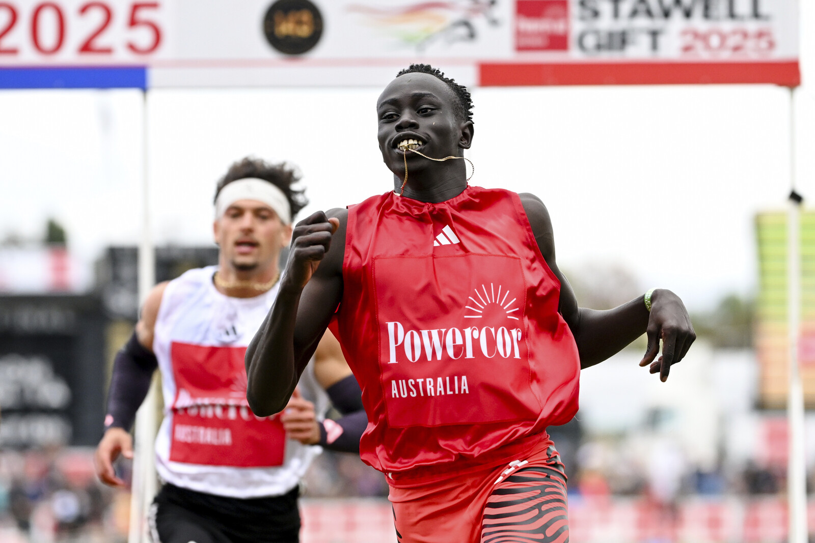 Teen Sprint Sensation Gout Gout
