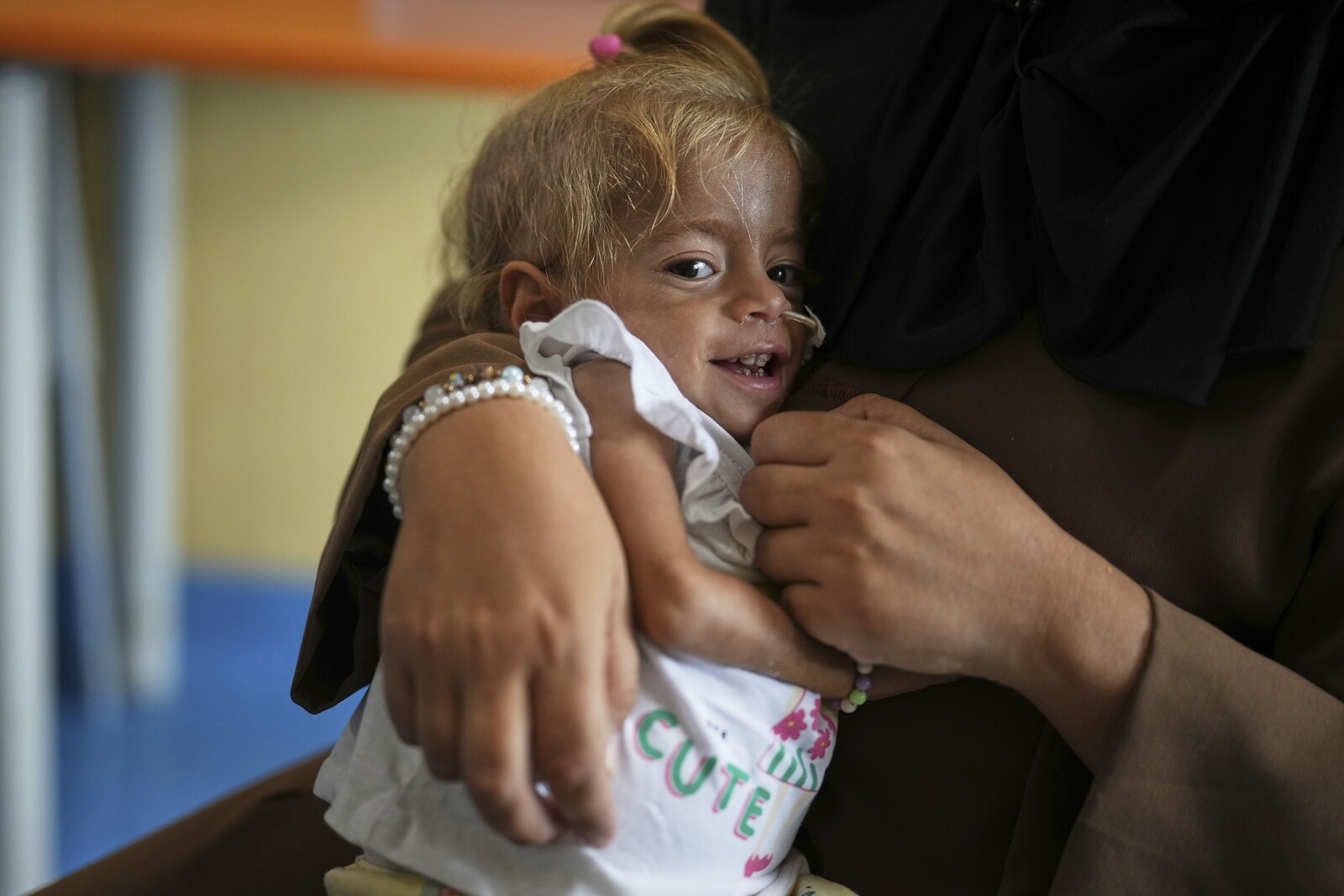 Gaza Toddler Shamm Finds New Hope with Treatment in Italy