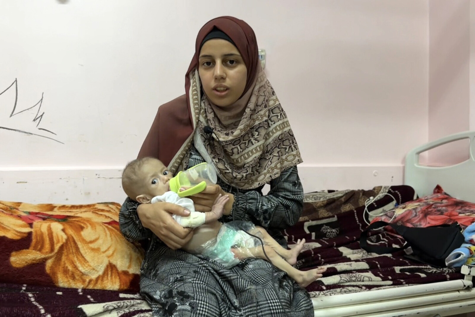 Images of Starvation in Gaza