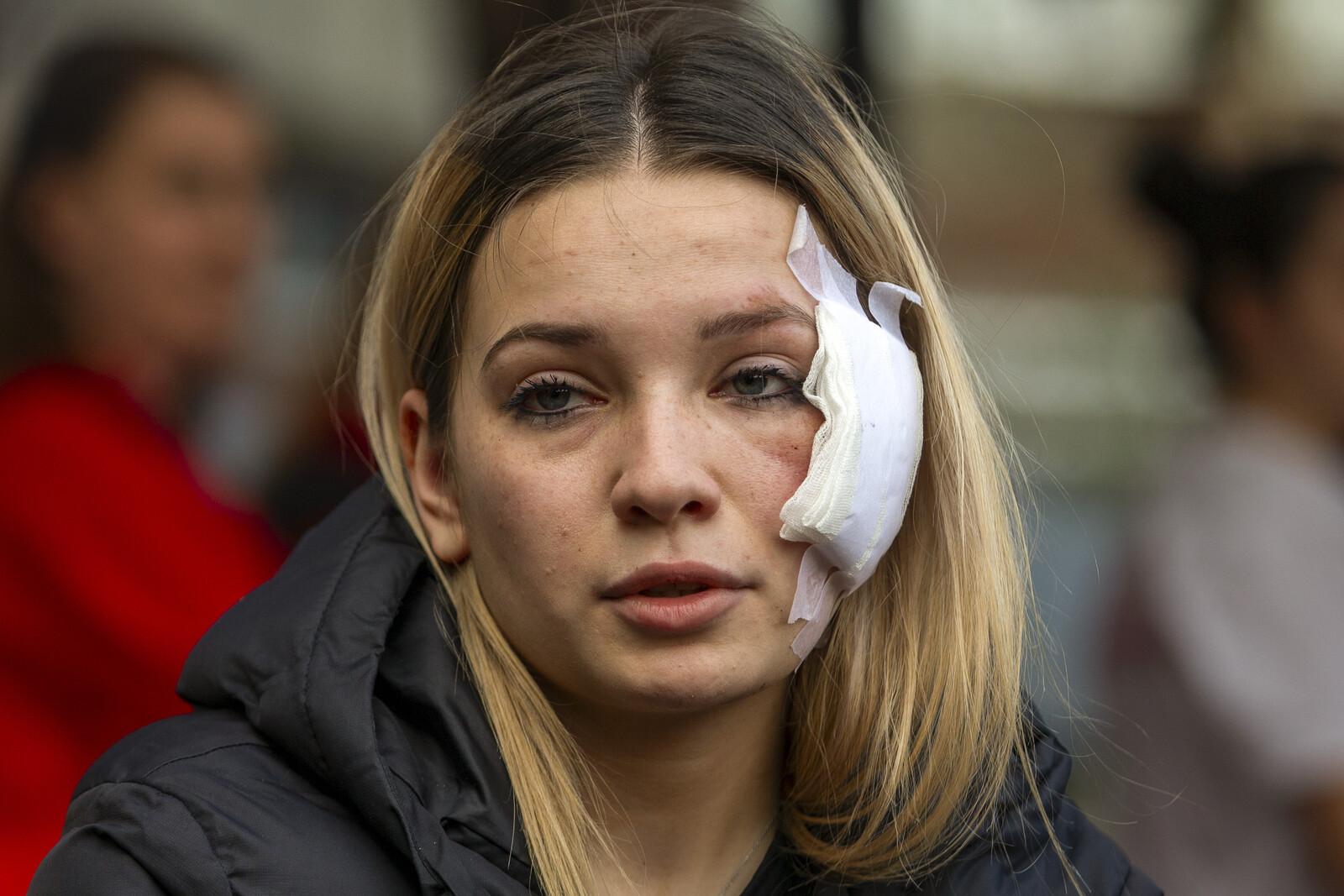 Marija survived the fire –