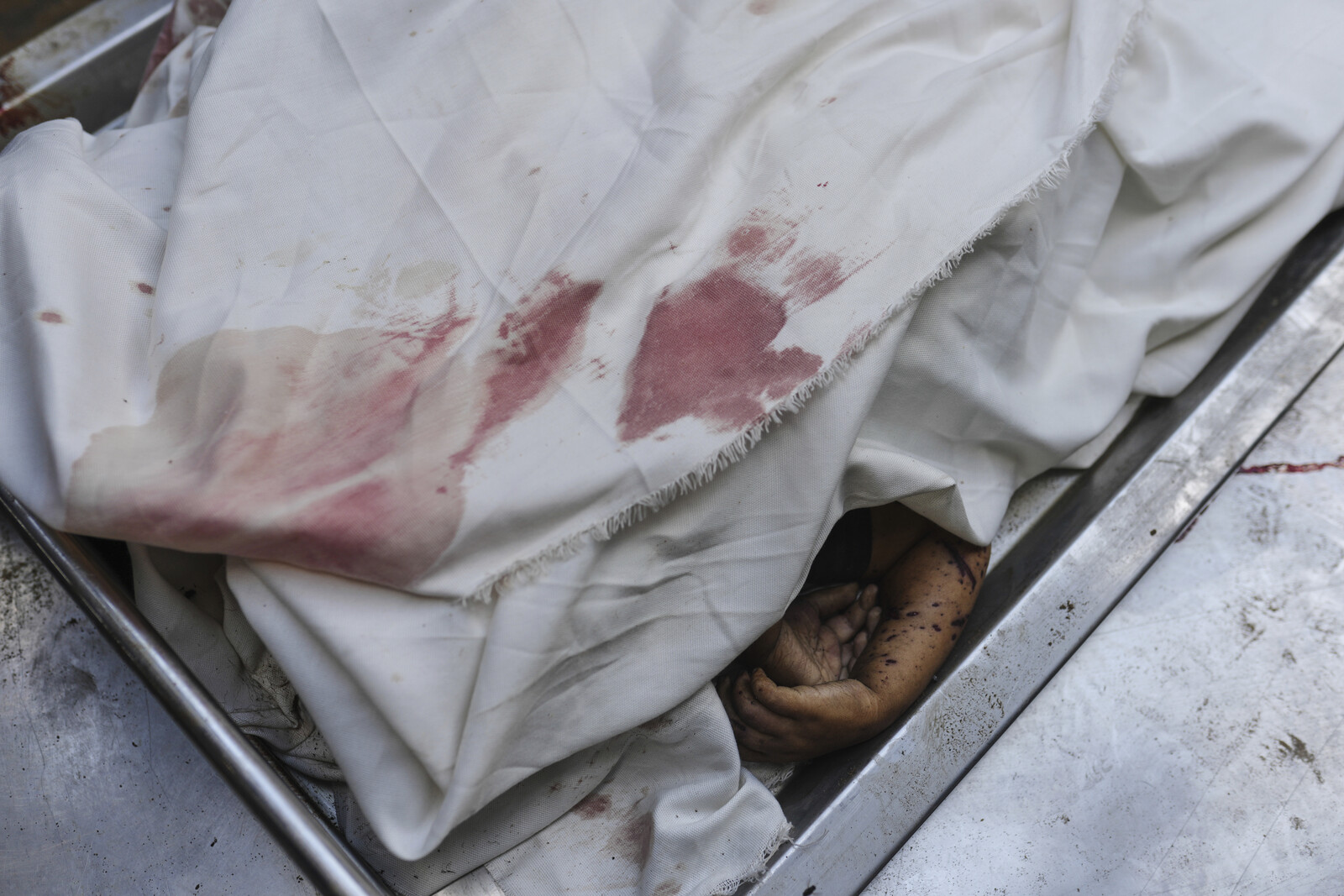 Gaza Hospitals Overwhelmed as Patients