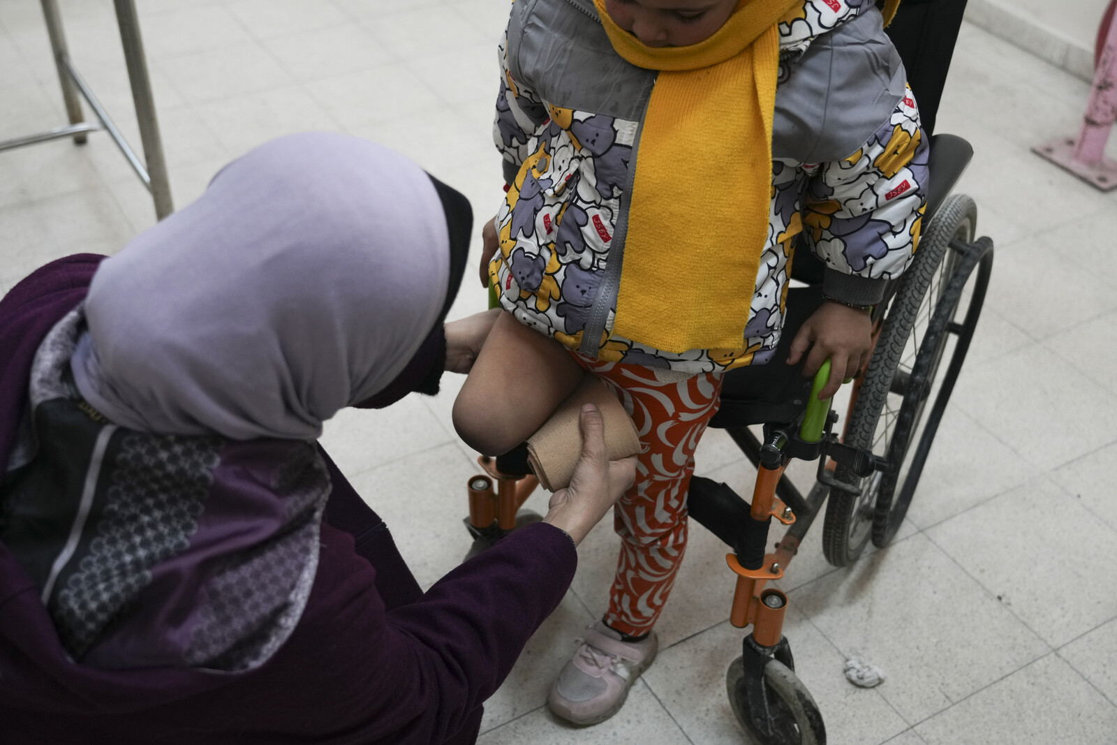 UN Reports Daily Limb Loss