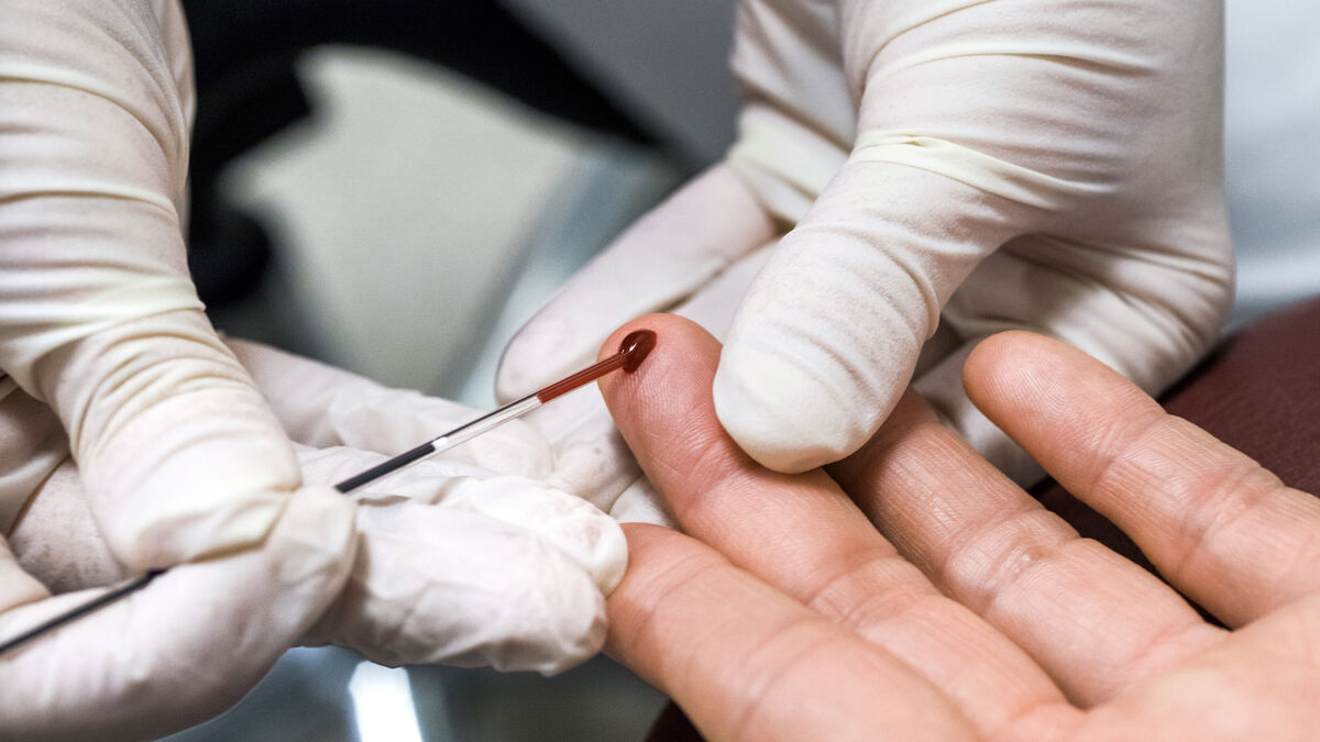 Doctors warn against private Alzheimer’s blood tests for healthy people