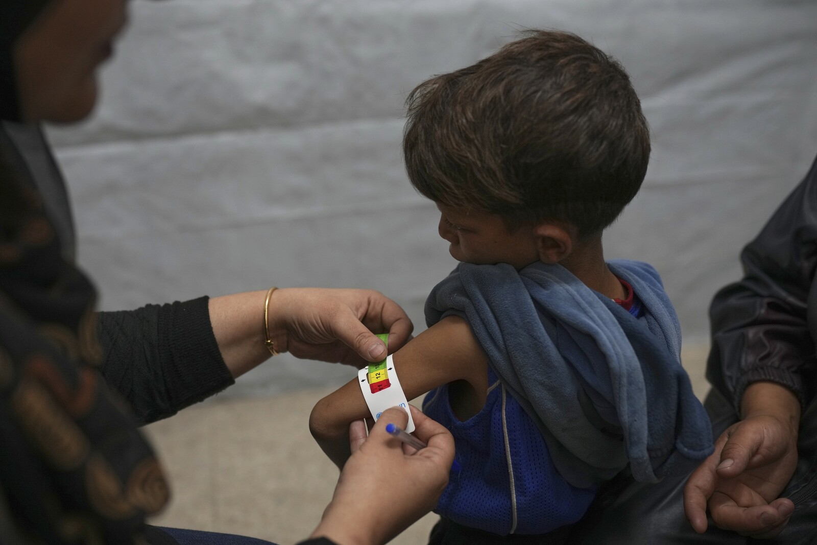 UN Warns of Rising Acute