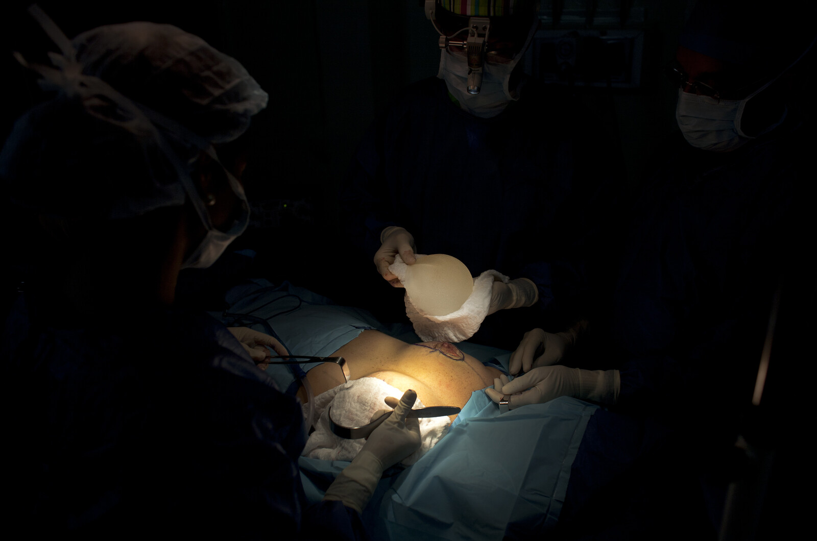 Small Business Owners Frustrated by Sick Pay for Cosmetic Surgery