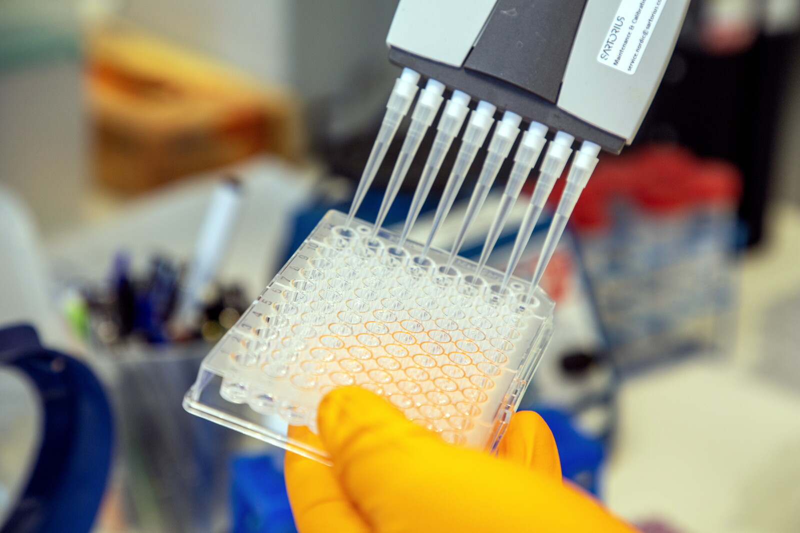 EU Approves Alzheimer's Drug Lecanemab for Sale