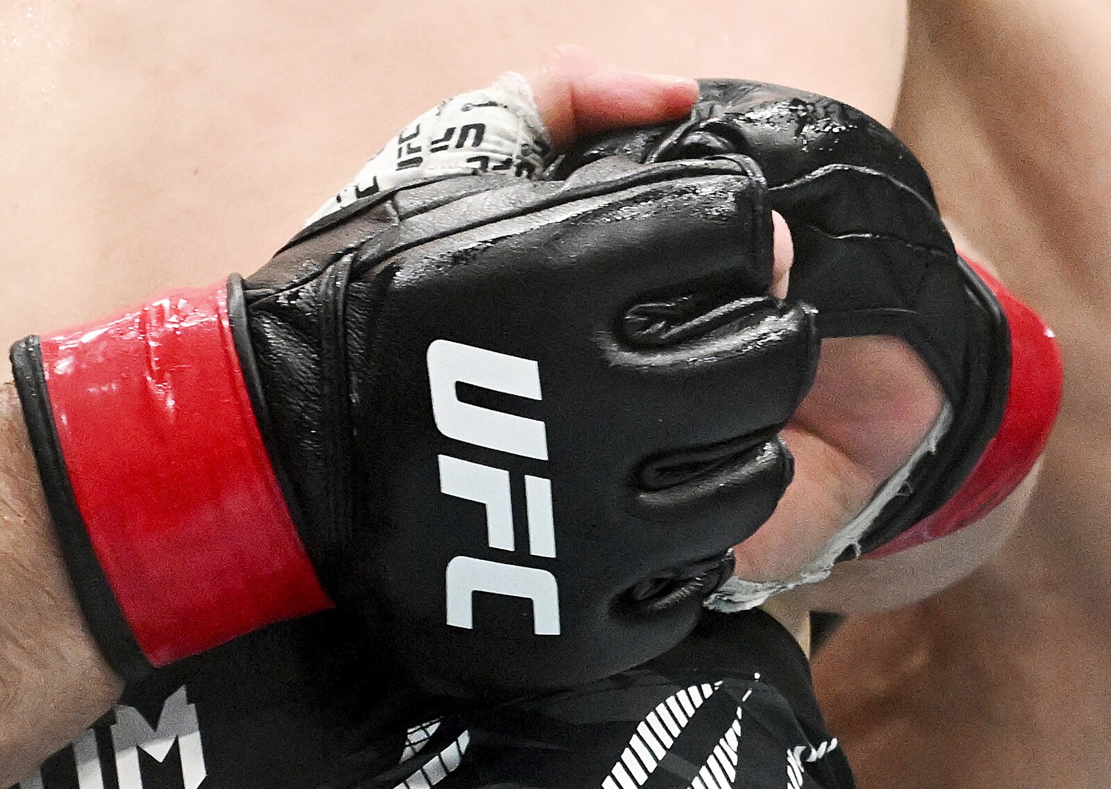 MMA Star Ben Askren Shares Near-Death Experience with Acute Pneumonia