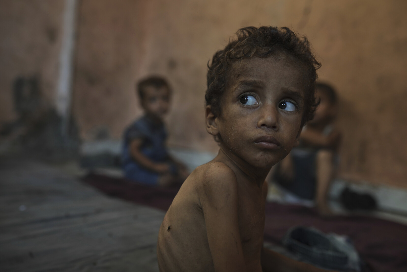 WHO Warns of Alarming Malnutrition