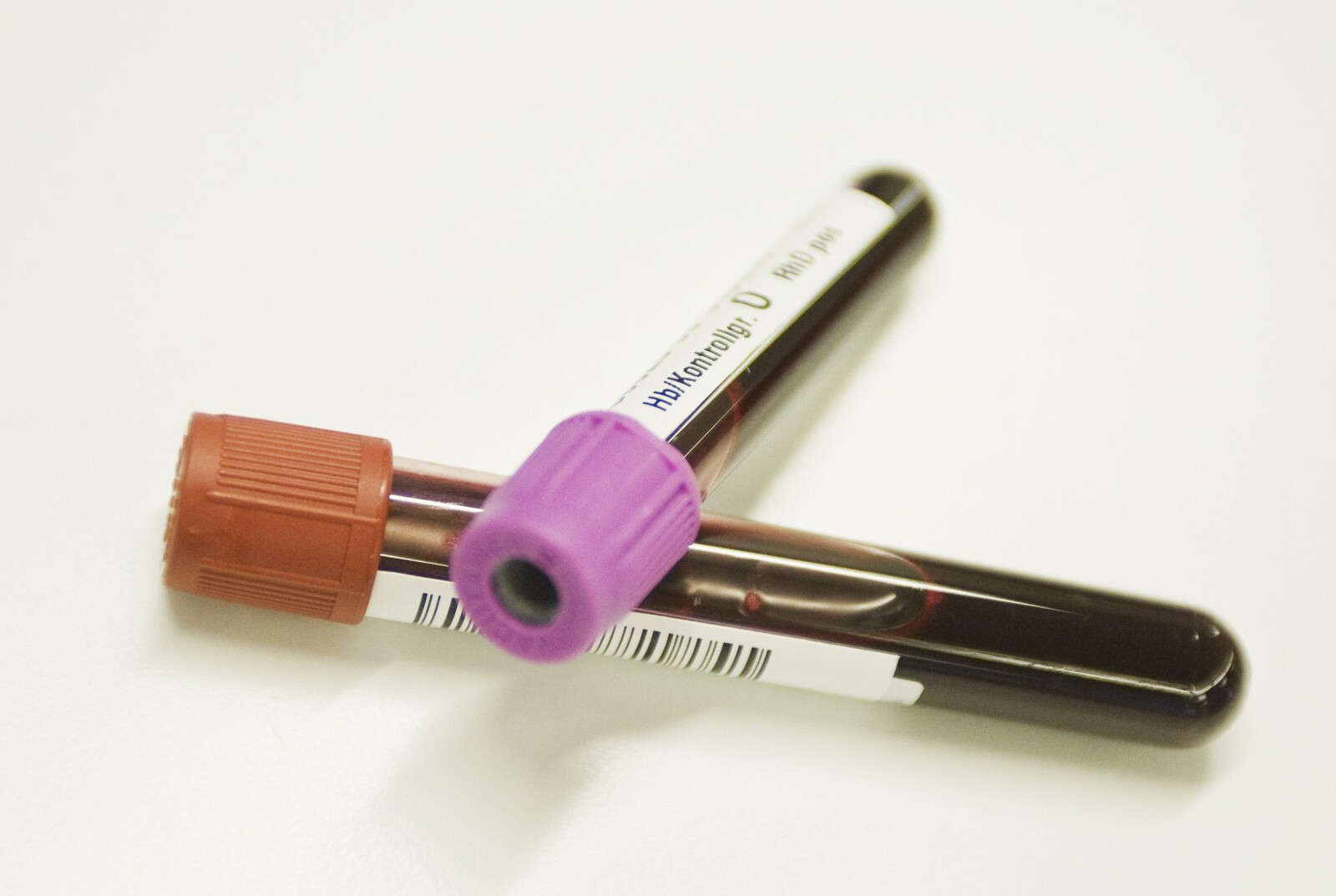 New Blood Group Gwada Negative Discovered by French Researchers