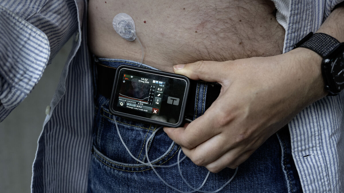 Type 1 diabetes breakthrough: Patient receives genetically modified insulin cells without immunosuppressants