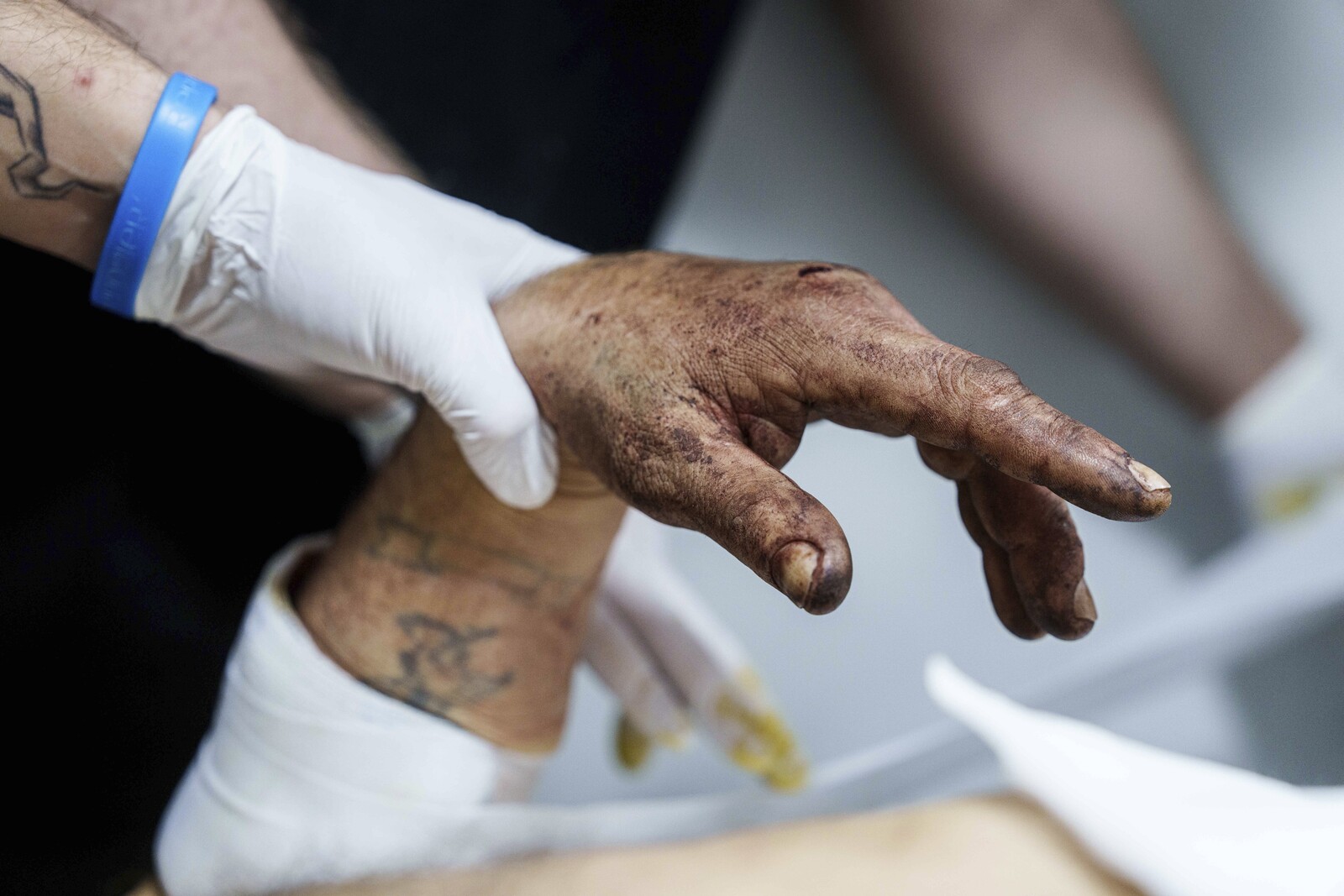 Ukrainian Surgeons Perform Operations in